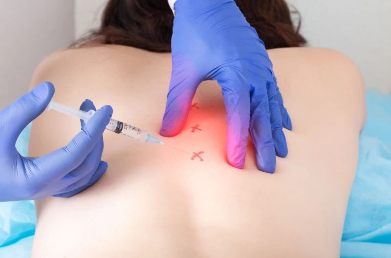 Facet Joint Injections