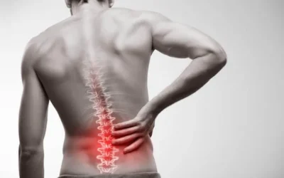 How Physical Therapy Can Help Relieve Your Sciatica