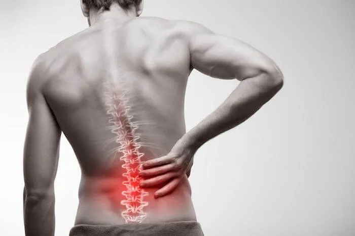 Sciatica Pain