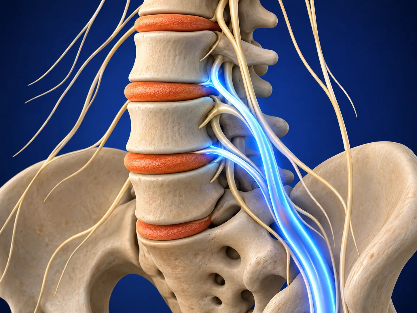 Anatomical illustration of the lower spine and nerves, representing spinal cord stimulator treatment