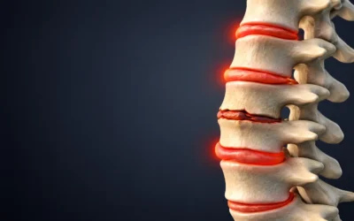Things to Avoid With Degenerative Disc Disease