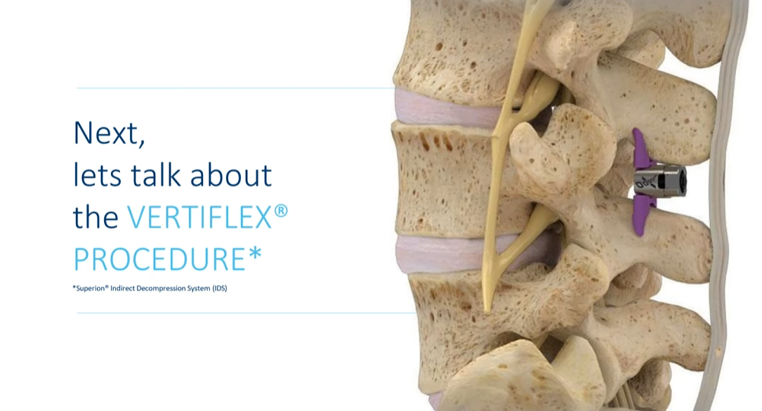 Advancements in the Treatment of Chronic Pain